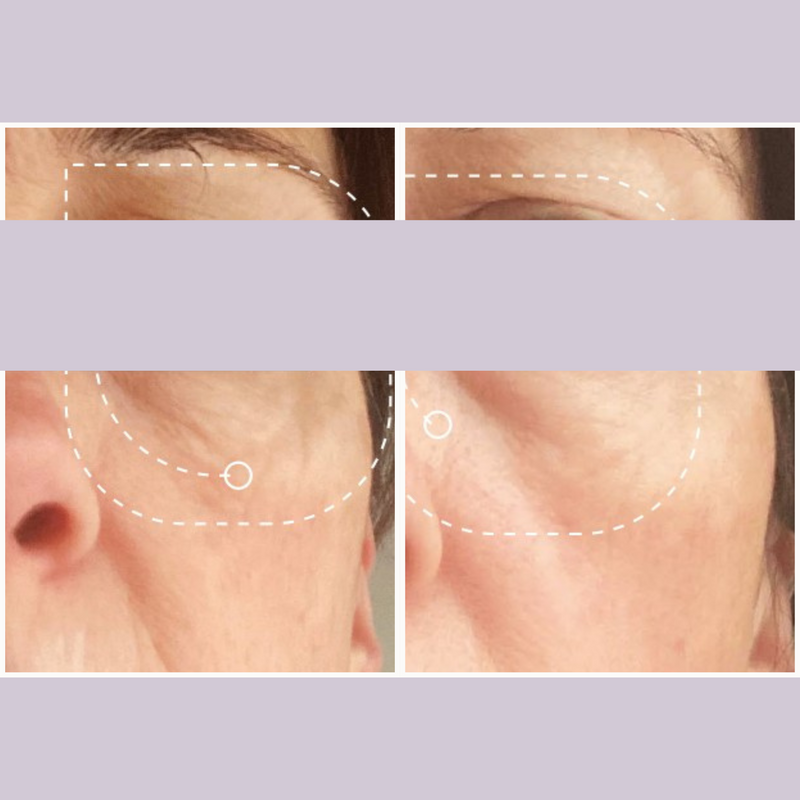 Ultralift Gesichtsserum für Feuchtigkeit, 30 ml