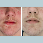 Skin Polish Scrub