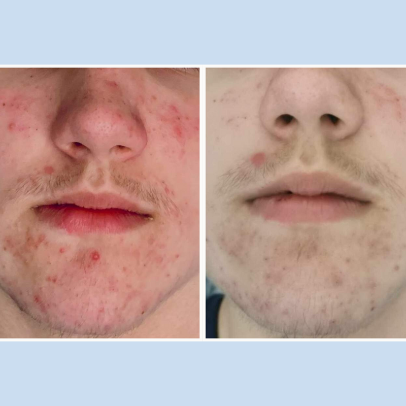 Skin Polish Scrub