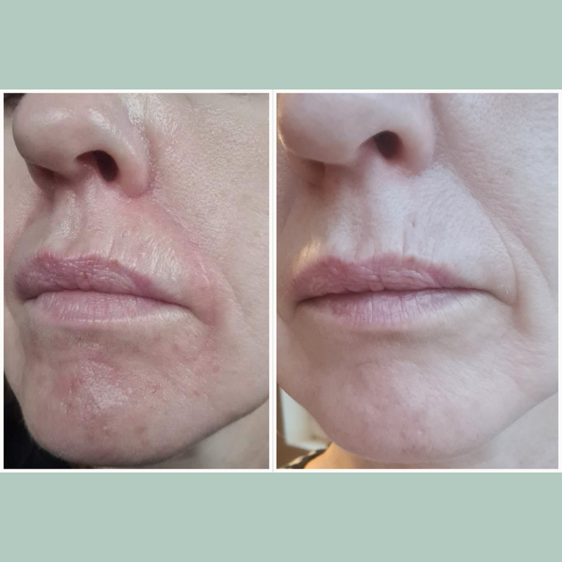 Botanical Blend Deep Replenish Serum