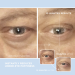 Eye Serum for Dark Circles & Puffiness