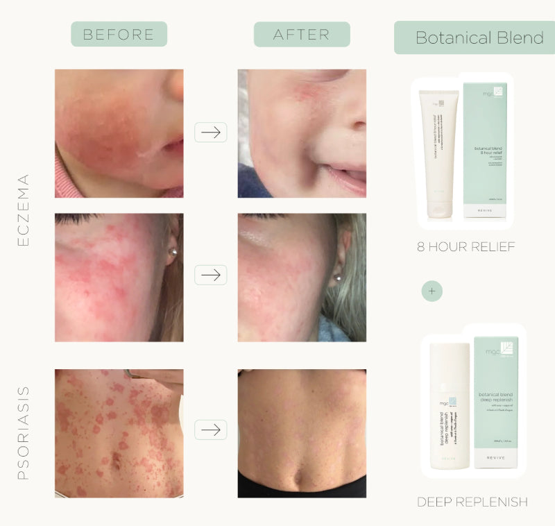 MGC Derma