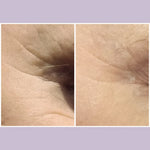 Wrinkle Repair & Skin Tightening Bio-Coll@gen™ Set