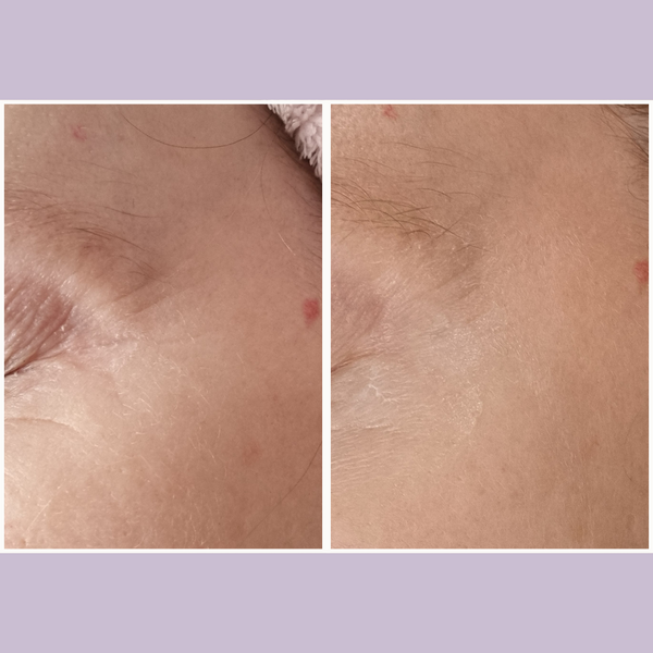 Wrinkle Repair & Skin Tightening Bio-Coll@gen™ Set